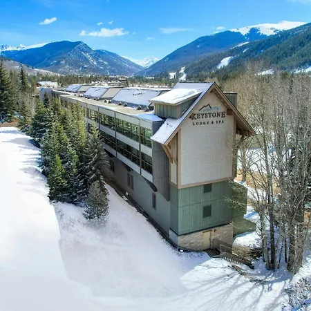 Keystone Lodge & Spa, A Vail Resorts Property-3